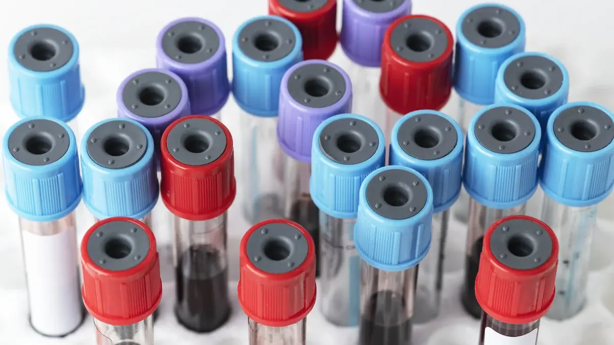 Blood collection tubes with red, purple and blue caps standing in a laboratory rack