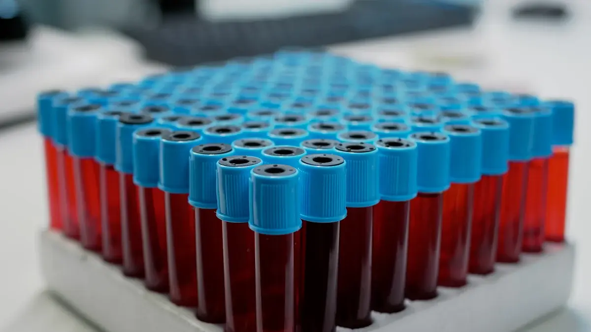 A tray of blue capped blood collection tubes filled with blood on a laboratory bench