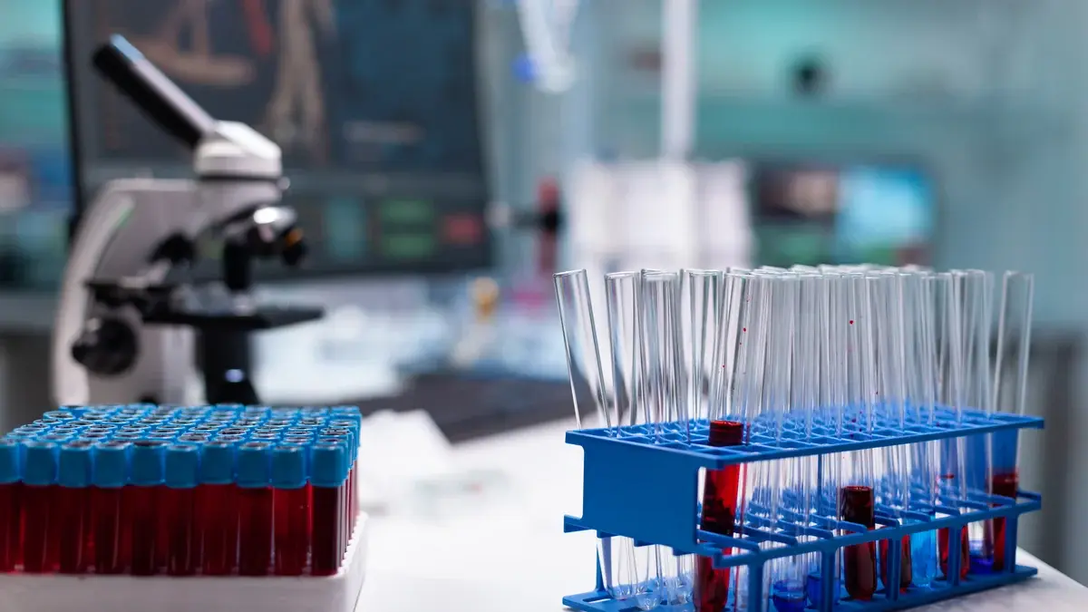 A rack of empty glass tubes beside a tray of filled blood collection tubes on a pathology bench